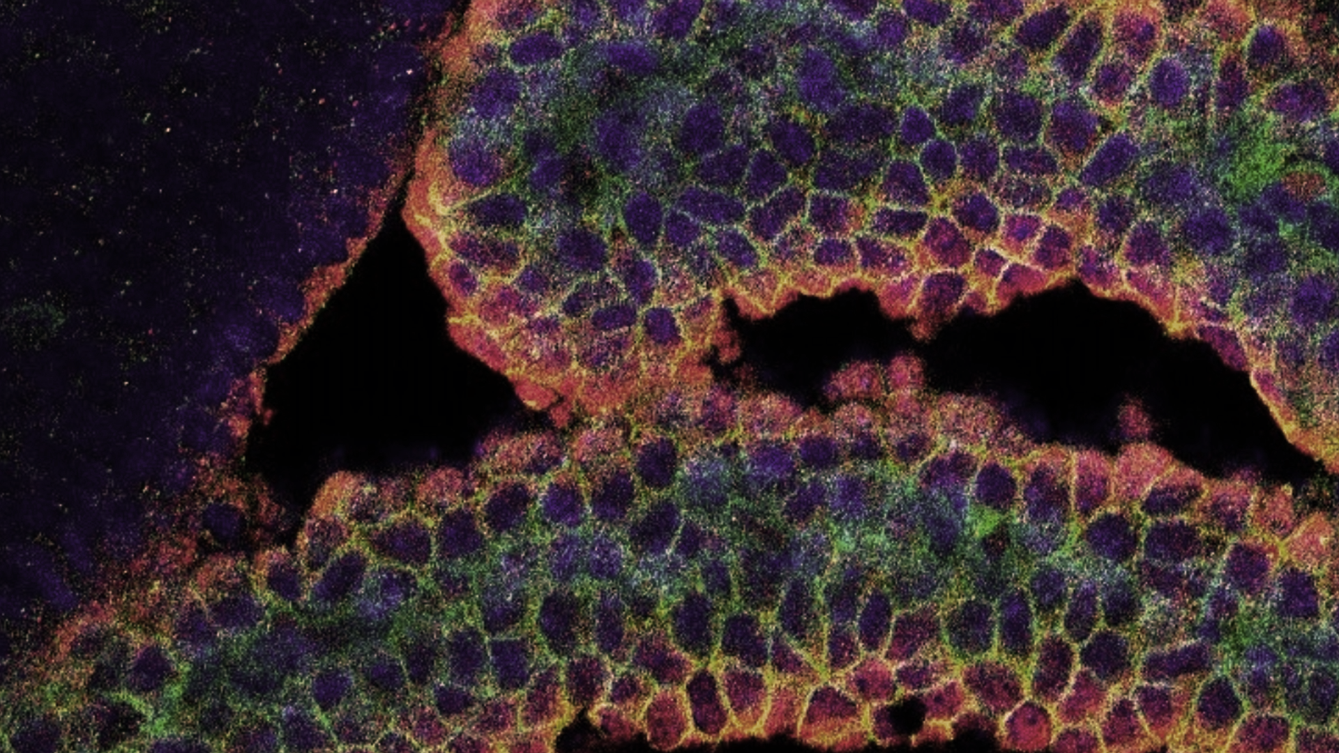 Photo Credit: Arpan Parichha, PhD thesis guided by Shubha Tole